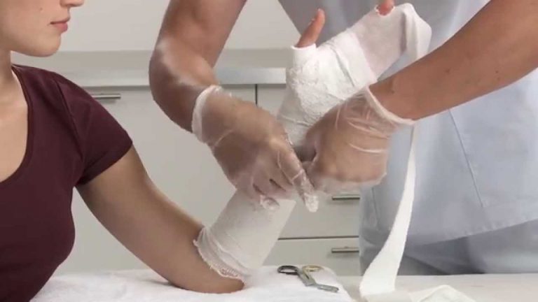 how to make wrist plasters