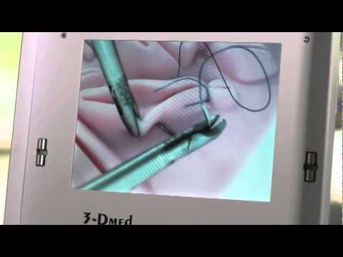 lapraoscopic suturing video