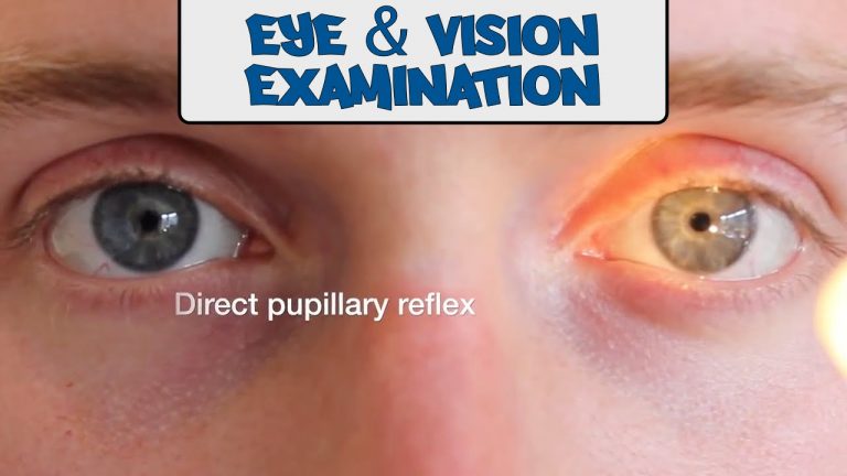 peripheral vascular examinationo