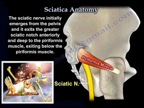 Sciatica Anatomy  by Dr. Nabil Ebraheim