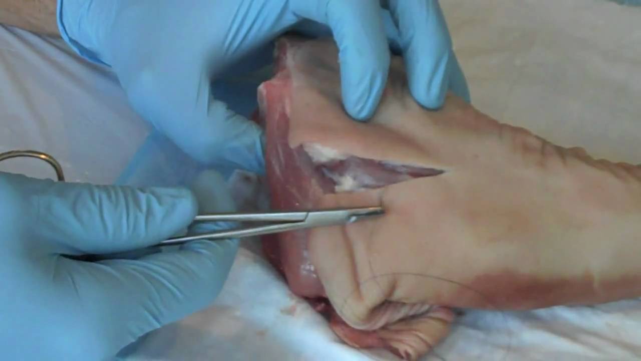 suture basic technique video