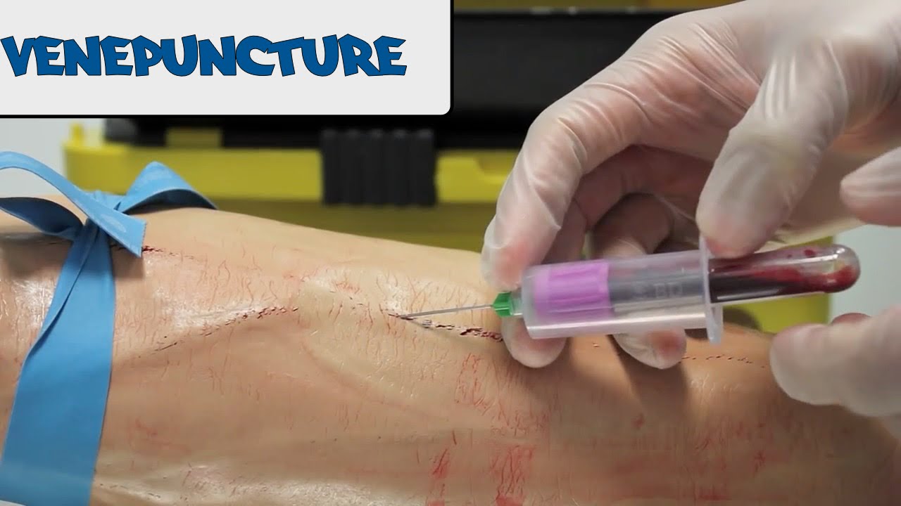 Venopunture |taking blood