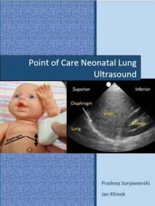 first book from Asia in the field of Point of care Neonatal Lung Ultrasound.