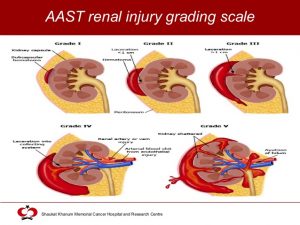 Renal Injury Study notes for Exam