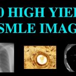 learn high yield usmle images in