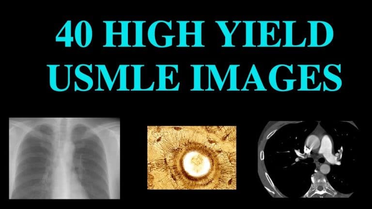 learn high yield usmle images in