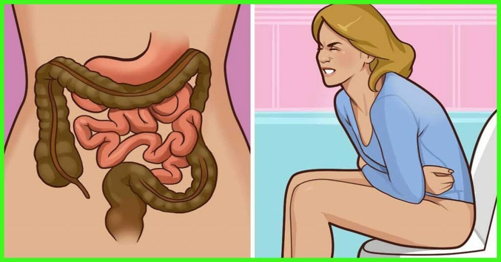 Constipation and How to Get Rid of it 
