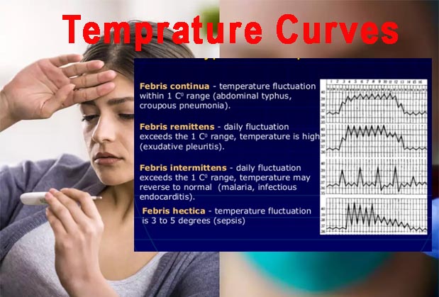Know about Temperature Curves Medical study notes