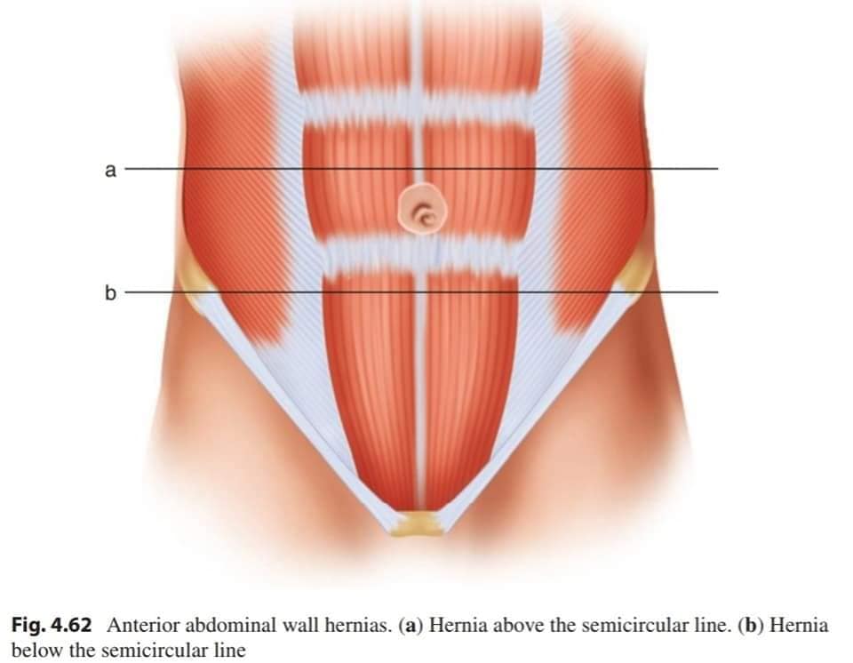 Lateral Ventral Layers in Abdomen
