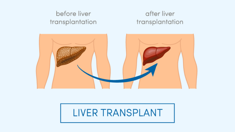 Liver1