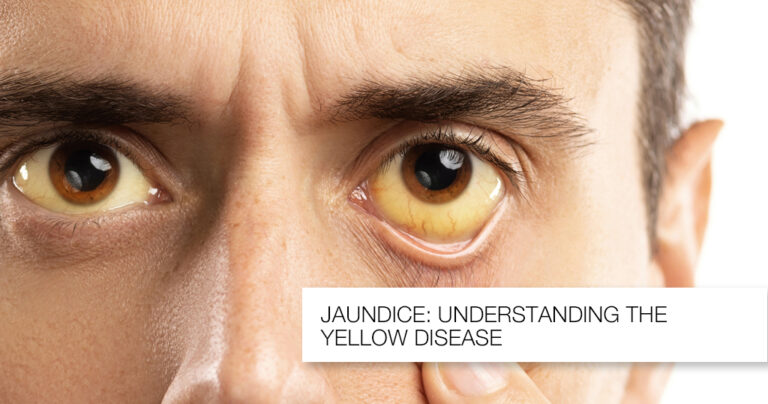medicospace-Images_Jaundice