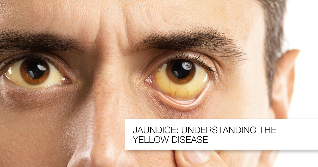 Jaundice - Pathophysiology